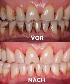 Seurico™ Gum Repair & Oral Health Powder