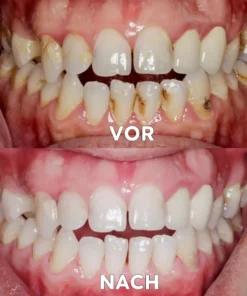 Seurico™ Gum Repair & Oral Health Powder