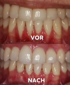 Seurico™ Gum Repair & Oral Health Powder