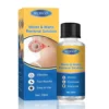 Seurico™ Moles & Warts Removal Solution