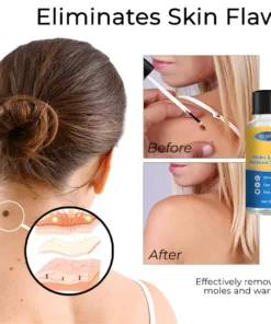 Seurico™ Moles & Warts Removal Solution
