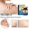 Seurico™ Nevus Removal Cream