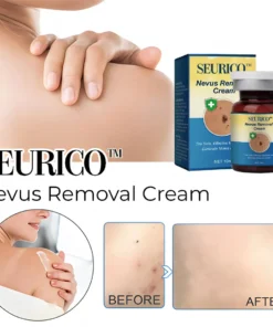 Seurico™ Nevus Removal Cream