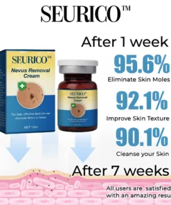 Seurico™ Nevus Removal Cream