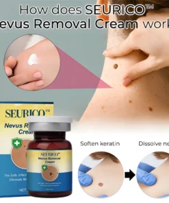 Seurico™ Nevus Removal Cream