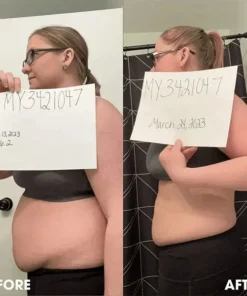 Seurico™ Slimming Power Patches