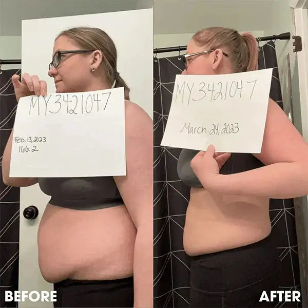 Seurico™ Slimming Power Patches