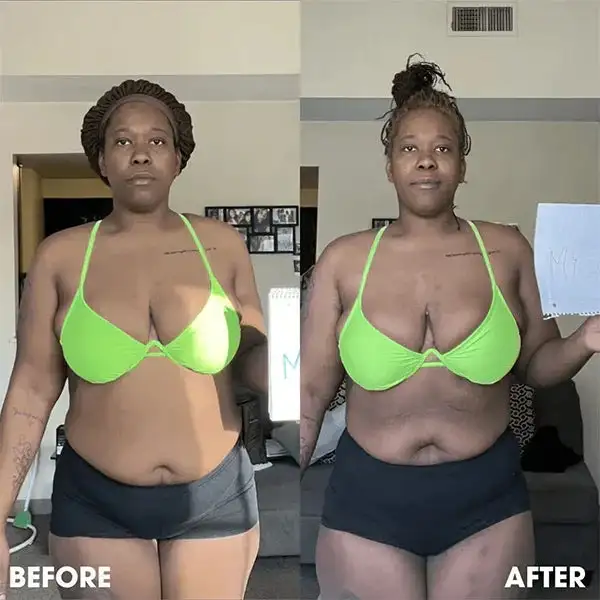Seurico™ Slimming Power Patches