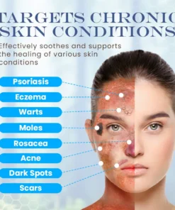 Seurico™ Snail Mucin Skin Treatment Cream