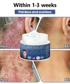 Seurico™ Snail Mucin Skin Treatment Cream