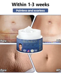 Seurico™ Snail Mucin Skin Treatment Cream
