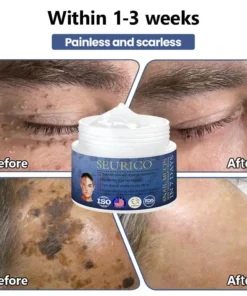 Seurico™ Snail Mucin Skin Treatment Cream
