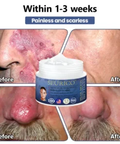 Seurico™ Snail Mucin Skin Treatment Cream