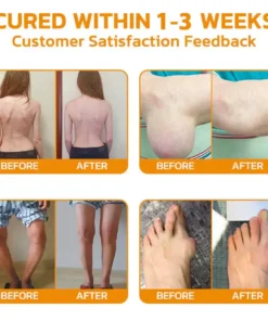 SEURICO™ Bee Venom Joint Repair Cream