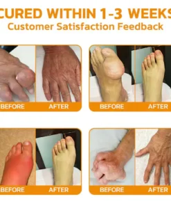 SEURICO™ Bee Venom Joint Repair Cream