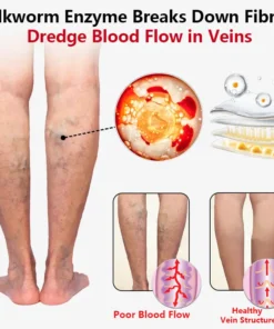 SEURICO™ Vein Dredge Silkworm Extract Spray