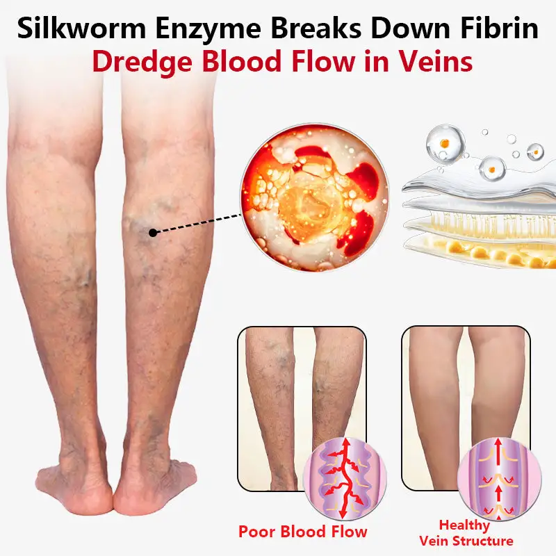 SEURICO™ Vein Dredge Silkworm Extract Spray
