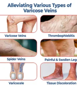 SEURICO™ Vein Dredge Silkworm Extract Spray
