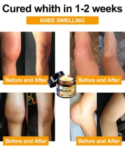 Seurico™ BeeVenom Pain-Relief Bone Healing Cream