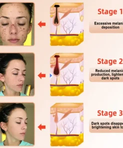Seurico™ Exfoliating Gel