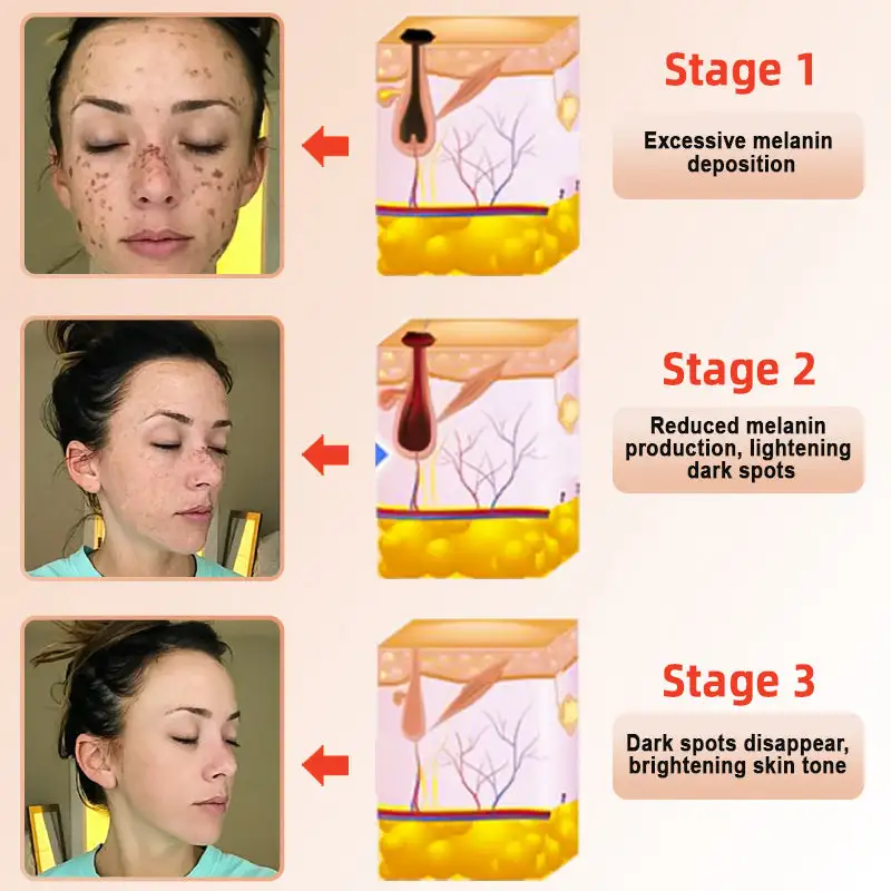 Seurico™ Exfoliating Gel