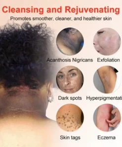 Seurico™ Exfoliating Gel