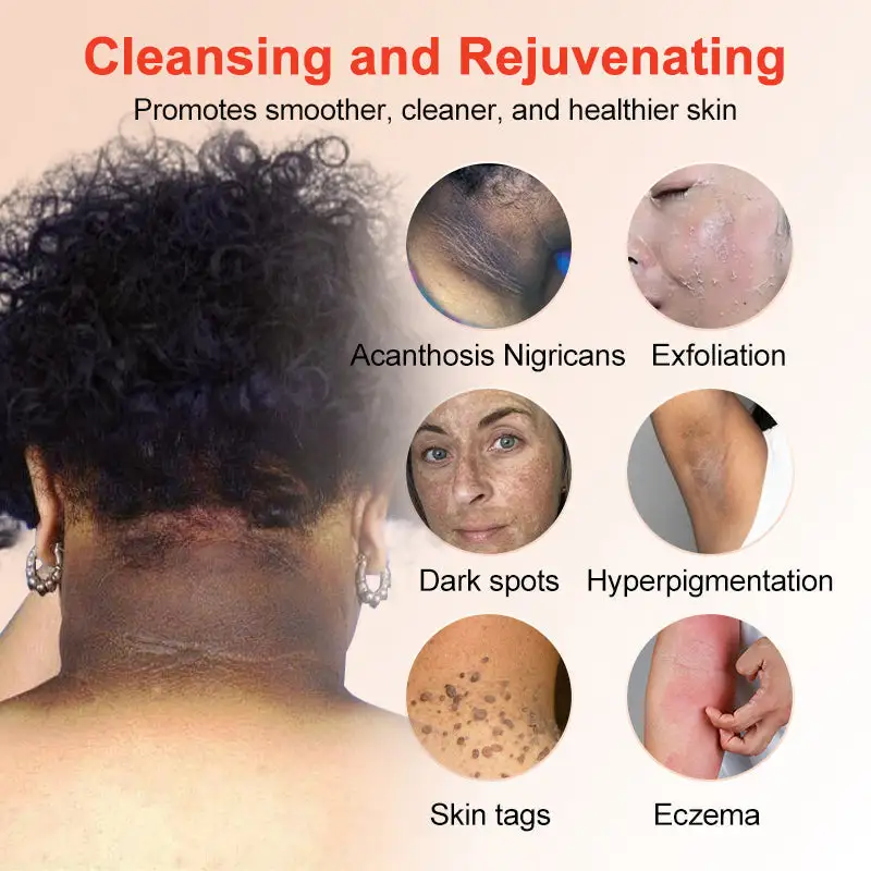 Seurico™ Exfoliating Gel