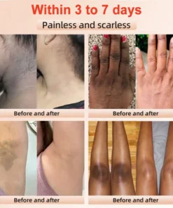 Seurico™ Exfoliating Gel
