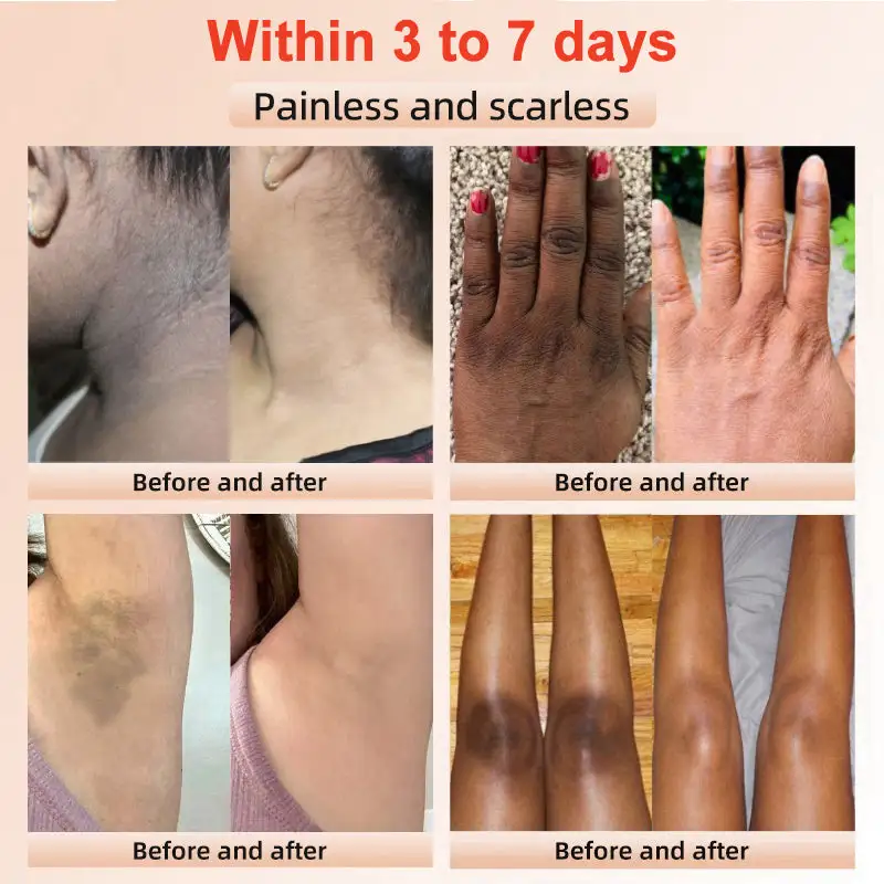 Seurico™ Exfoliating Gel
