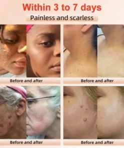 Seurico™ Exfoliating Gel