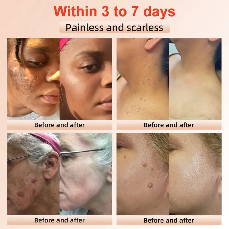 Seurico™ Exfoliating Gel