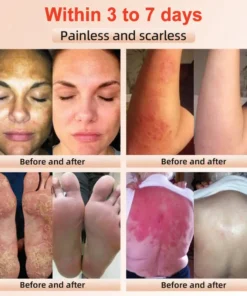 Seurico™ Exfoliating Gel