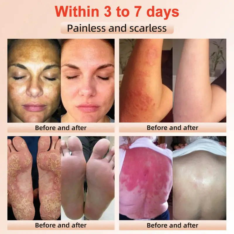 Seurico™ Exfoliating Gel