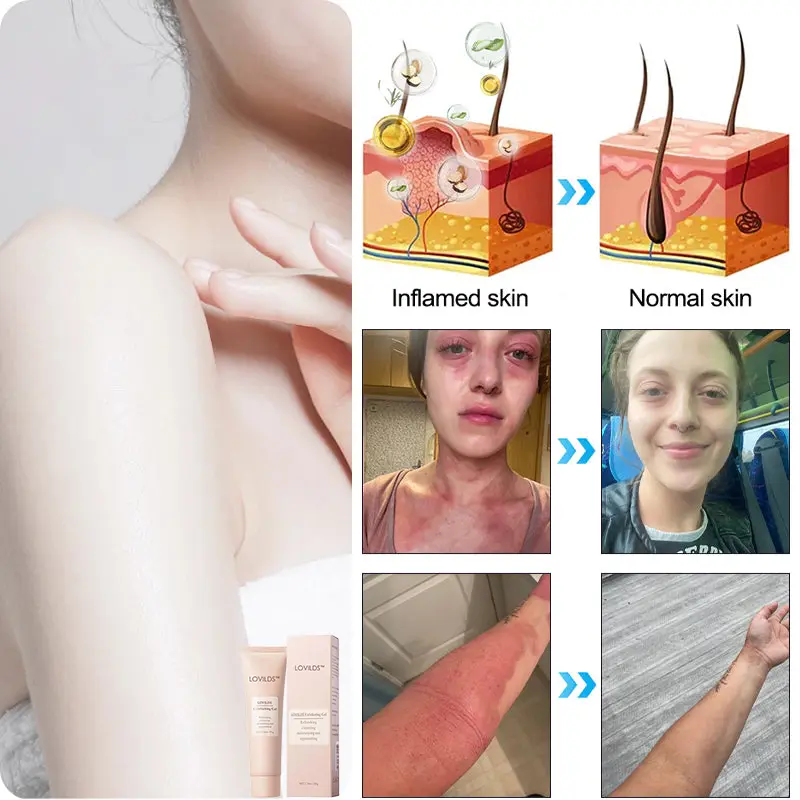 Seurico™ Exfoliating Gel