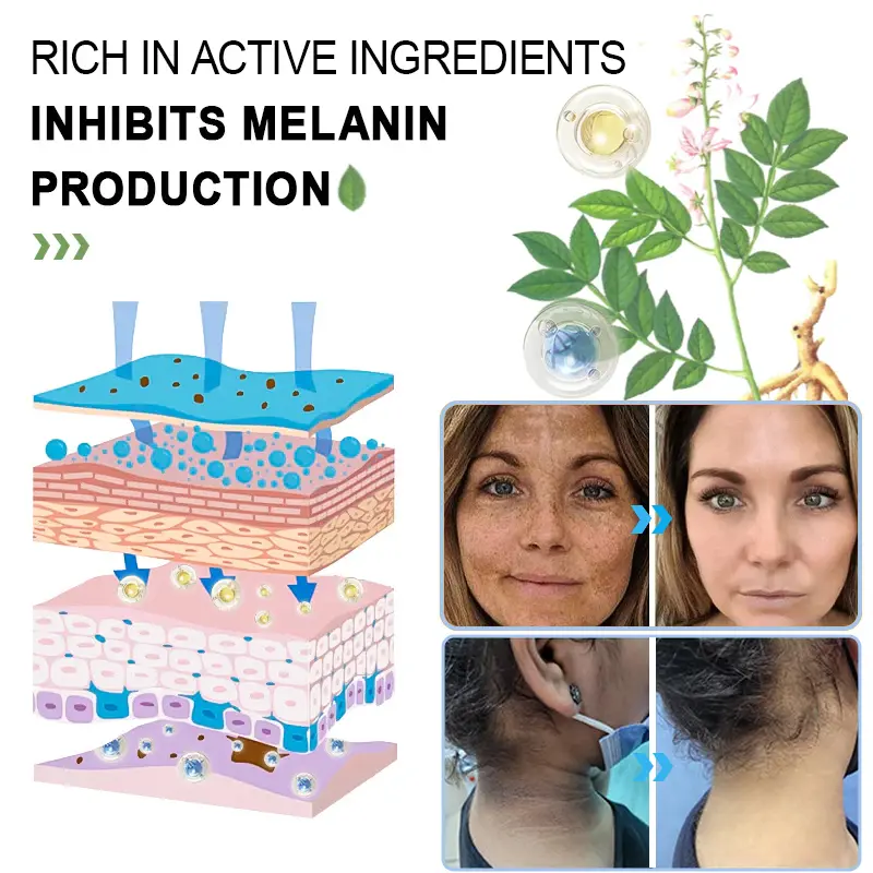 Seurico™ Exfoliating Gel