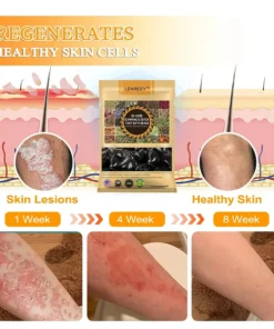 Seurico™ Herbal VenoDetox Foot Bath Beads