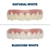 Seurico™ Premium Cosmetic Teeth