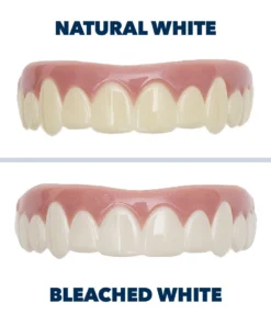 Seurico™ Premium Cosmetic Teeth