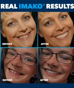 Seurico™ Premium Cosmetic Teeth