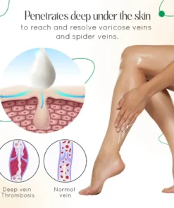 Seurico™ Varicose Vein Relief Cream