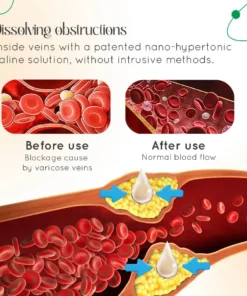 Seurico™ Varicose Vein Relief Cream