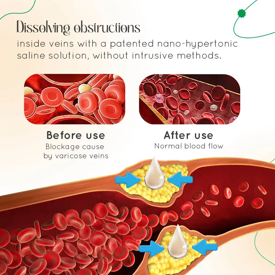 Seurico™ Varicose Vein Relief Cream