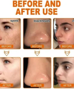 Seurico™ Whitening and Freckle - Removing Mask