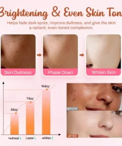Seurico™ Whitening and Freckle - Removing Mask