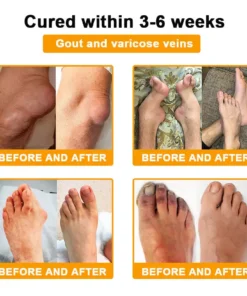 Seurico™ Botulinum Toxin & Bee Venom Pain-Relief Bone Healing Cream