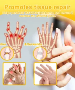 Seurico™ Botulinum Toxin & Bee Venom Pain-Relief Bone Healing Cream