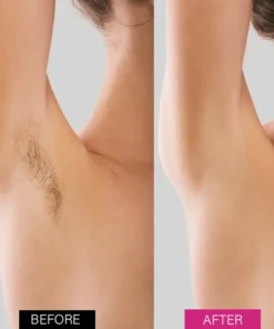 Seurico™ BeeSilk Hair Removal Mousse