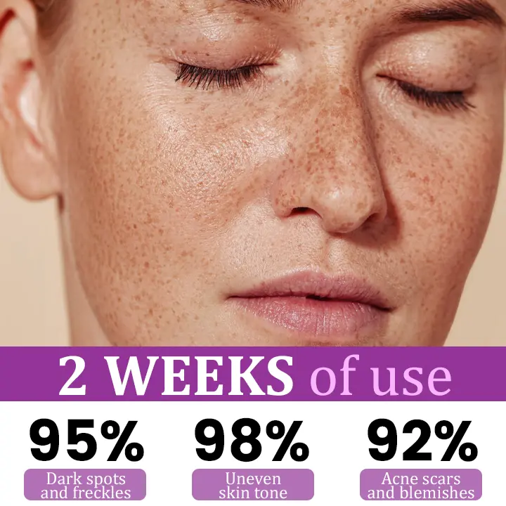 Seurico™ MelantraY Anti-Hyperpigmentation Essence