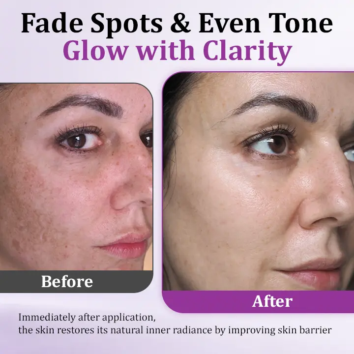 Seurico™ MelantraY Anti-Hyperpigmentation Essence