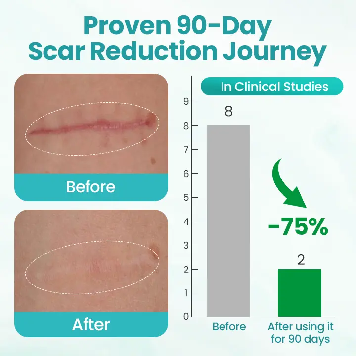 Seurico® EliteAloe ScarSolve Spray